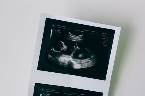 Panduan Ibu Hamil Trimester 2: Perubahan Tubuh dan Janin